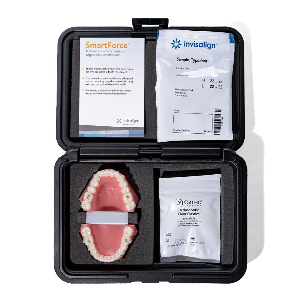 Invisalign™ Typodont, Class II Occlusion