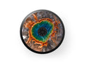 Invisalign aliger case design prismatic springs